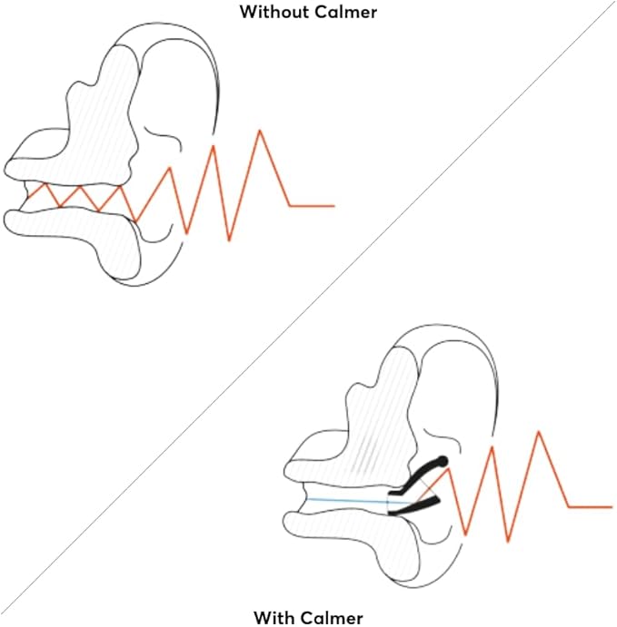 Flare Calmer Mini | Ear Plugs Alternative | Daily Noise Relief | Sound Sensitivity | Stress Relief | No Muffling | Improve Wellbeing | Comfy, Reusable, Soft Silicone Earplugs | Soft Blue
